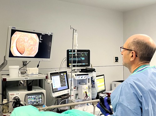 El diagnóstico precoz convierte en uno de los más curables al cáncer de colon , más del 90% de los casos se supera gracias a la detección temprana